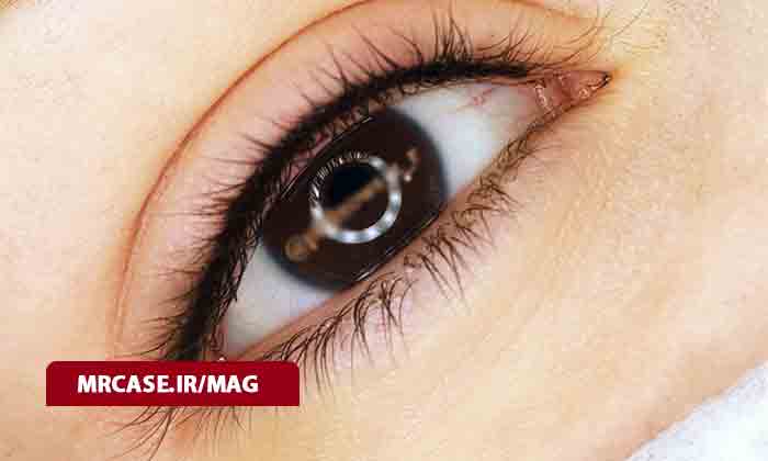 بن مژه چیست و چه خطراتی دارد ؟