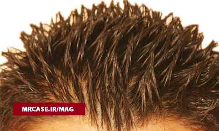 چرا مو چرب میشود ؟