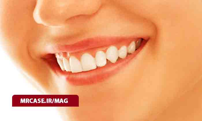 جوش لثه چیست و روش های درمان آن