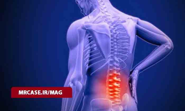 علت کمردرد هنگام نشستن