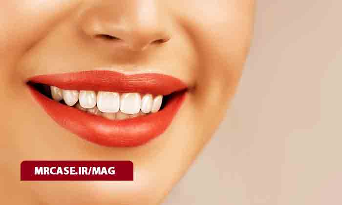 راه های طبیعی سفید کردن دندان