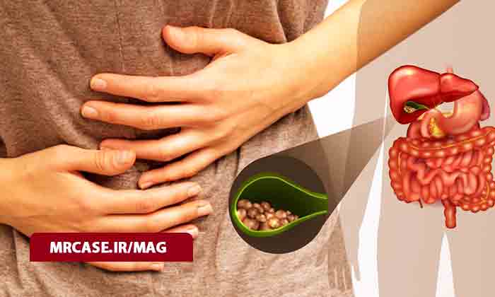کیسه صفرا و سنگ کیسه صفرا چیست ؟