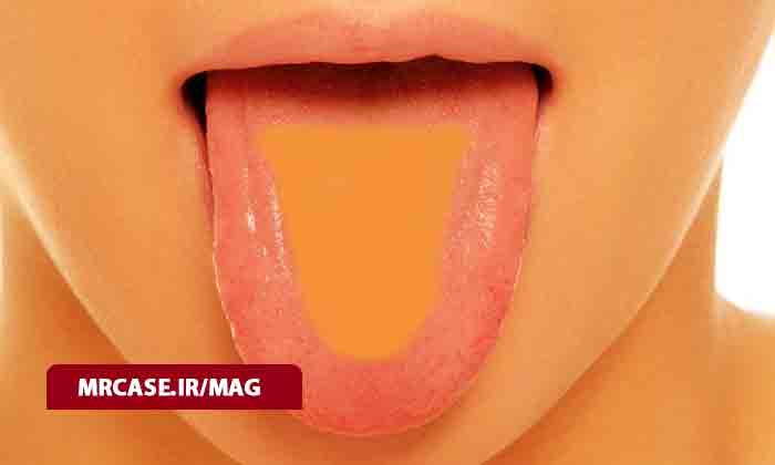 دلیل زردی زبان چیست؟