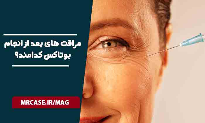 مراقت های بعد از انجام بوتاکس کدامند؟